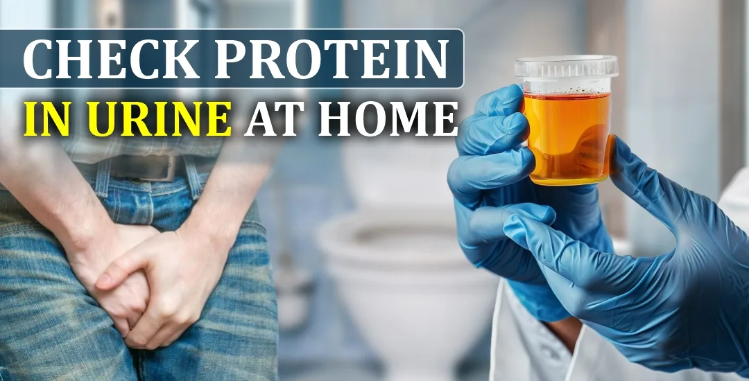 How to Check Protein in Urine at Home?